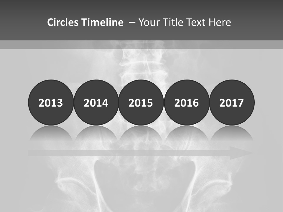 A X - Ray Image Of A Skeleton With The Words Name Of Presentation Company Name PowerPoint Template