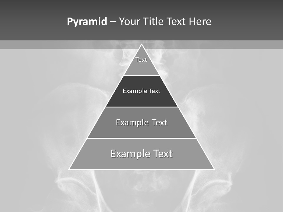 A X - Ray Image Of A Skeleton With The Words Name Of Presentation Company Name PowerPoint Template