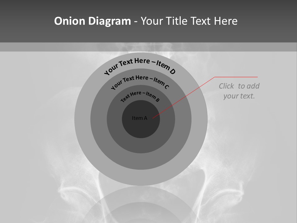 A X - Ray Image Of A Skeleton With The Words Name Of Presentation Company Name PowerPoint Template