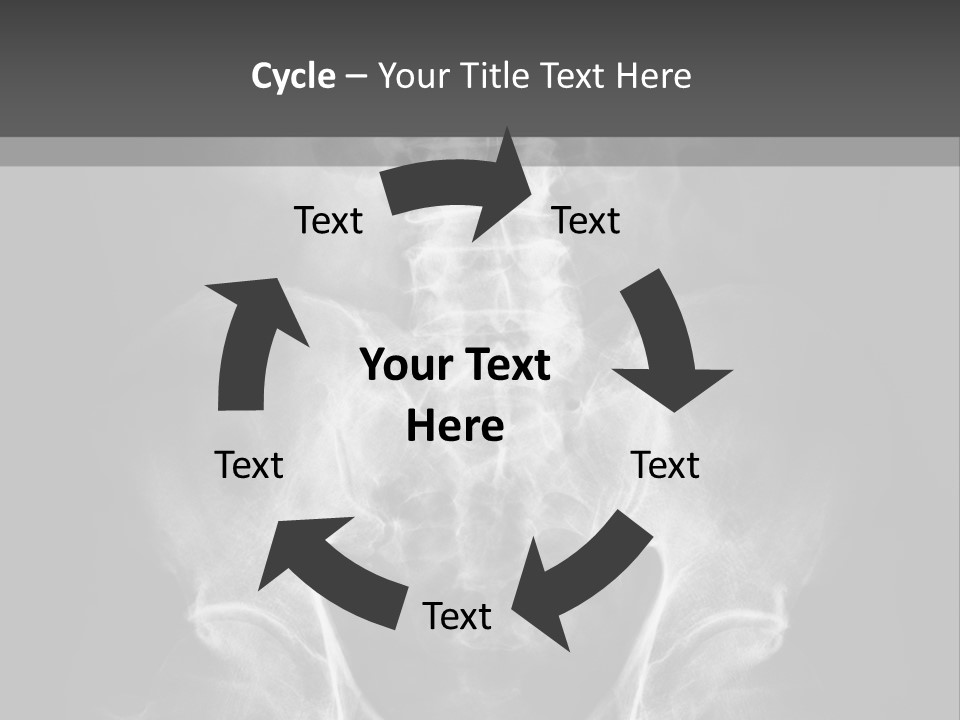 A X - Ray Image Of A Skeleton With The Words Name Of Presentation Company Name PowerPoint Template