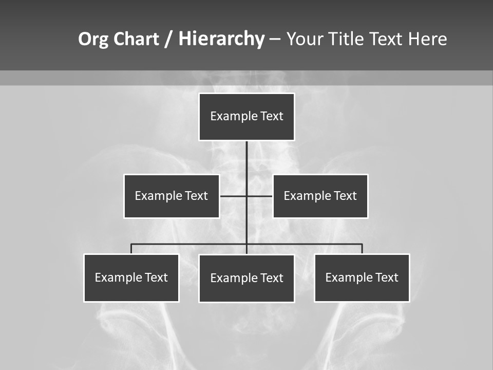 A X - Ray Image Of A Skeleton With The Words Name Of Presentation Company Name PowerPoint Template