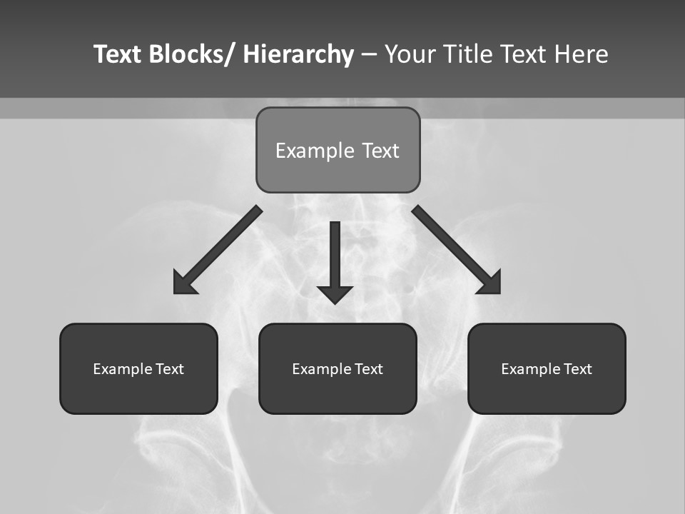 A X - Ray Image Of A Skeleton With The Words Name Of Presentation Company Name PowerPoint Template