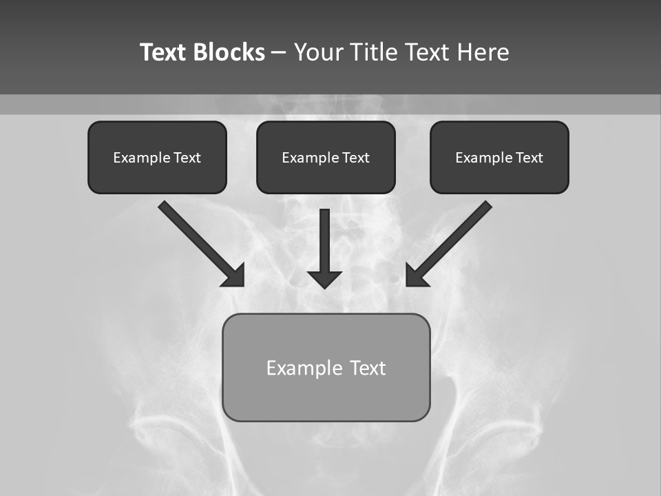 A X - Ray Image Of A Skeleton With The Words Name Of Presentation Company Name PowerPoint Template