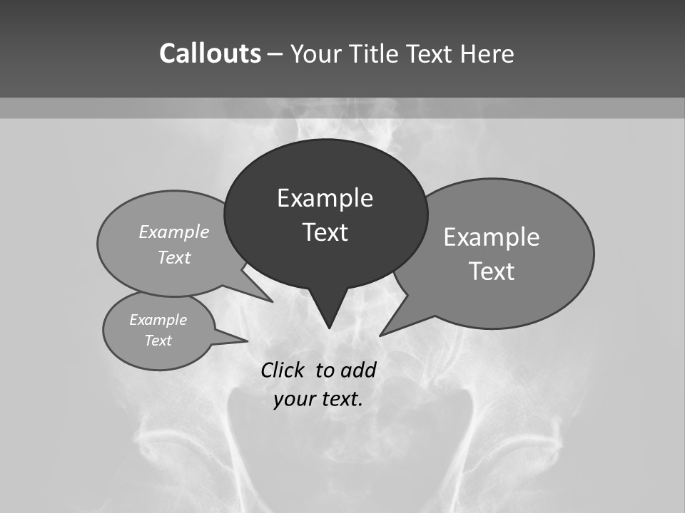A X - Ray Image Of A Skeleton With The Words Name Of Presentation Company Name PowerPoint Template