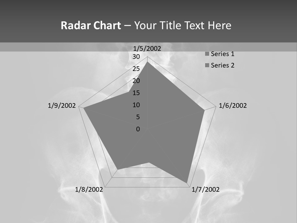 A X - Ray Image Of A Skeleton With The Words Name Of Presentation Company Name PowerPoint Template