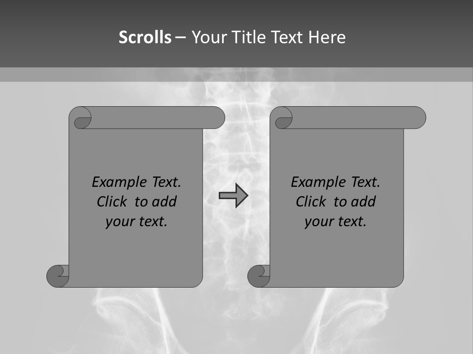 A X - Ray Image Of A Skeleton With The Words Name Of Presentation Company Name PowerPoint Template