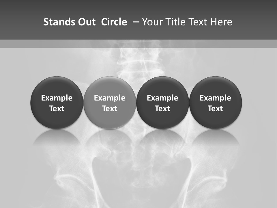 A X - Ray Image Of A Skeleton With The Words Name Of Presentation Company Name PowerPoint Template