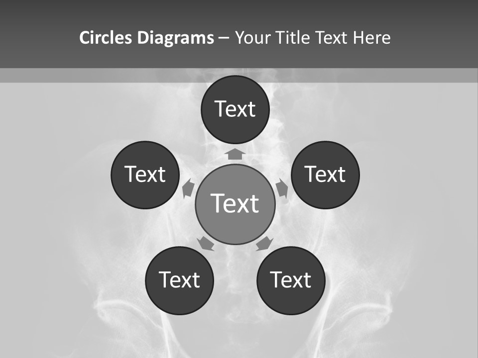 A X - Ray Image Of A Skeleton With The Words Name Of Presentation Company Name PowerPoint Template