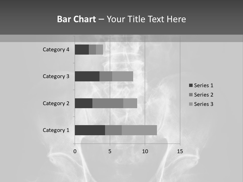 A X - Ray Image Of A Skeleton With The Words Name Of Presentation Company Name PowerPoint Template