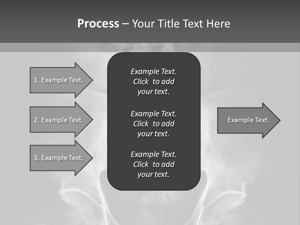 A X - Ray Image Of A Skeleton With The Words Name Of Presentation Company Name PowerPoint Template