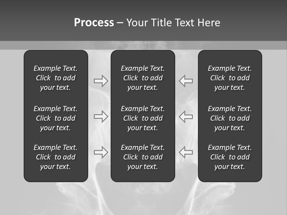 A X - Ray Image Of A Skeleton With The Words Name Of Presentation Company Name PowerPoint Template