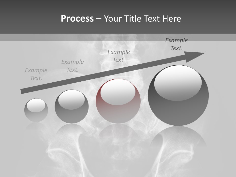 A X - Ray Image Of A Skeleton With The Words Name Of Presentation Company Name PowerPoint Template