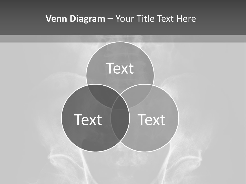 A X - Ray Image Of A Skeleton With The Words Name Of Presentation Company Name PowerPoint Template