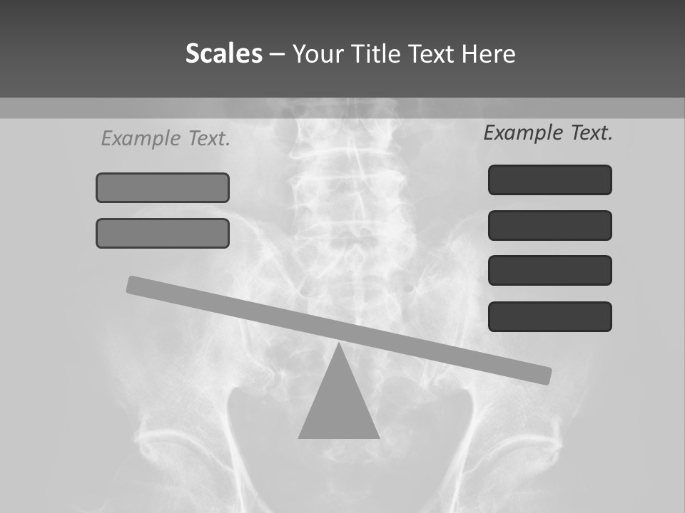 A X - Ray Image Of A Skeleton With The Words Name Of Presentation Company Name PowerPoint Template