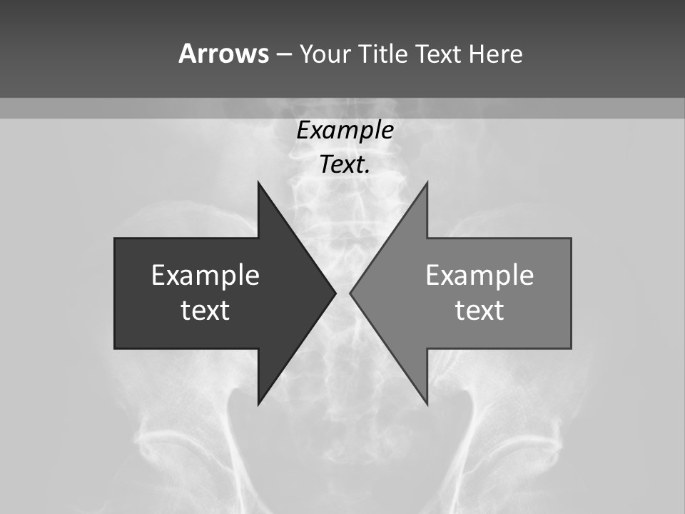A X - Ray Image Of A Skeleton With The Words Name Of Presentation Company Name PowerPoint Template