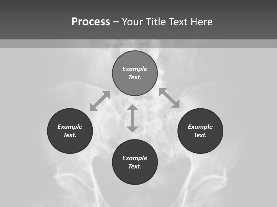 A X - Ray Image Of A Skeleton With The Words Name Of Presentation Company Name PowerPoint Template