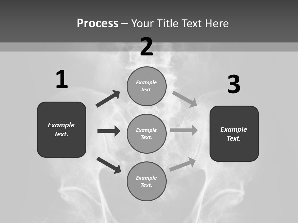 A X - Ray Image Of A Skeleton With The Words Name Of Presentation Company Name PowerPoint Template