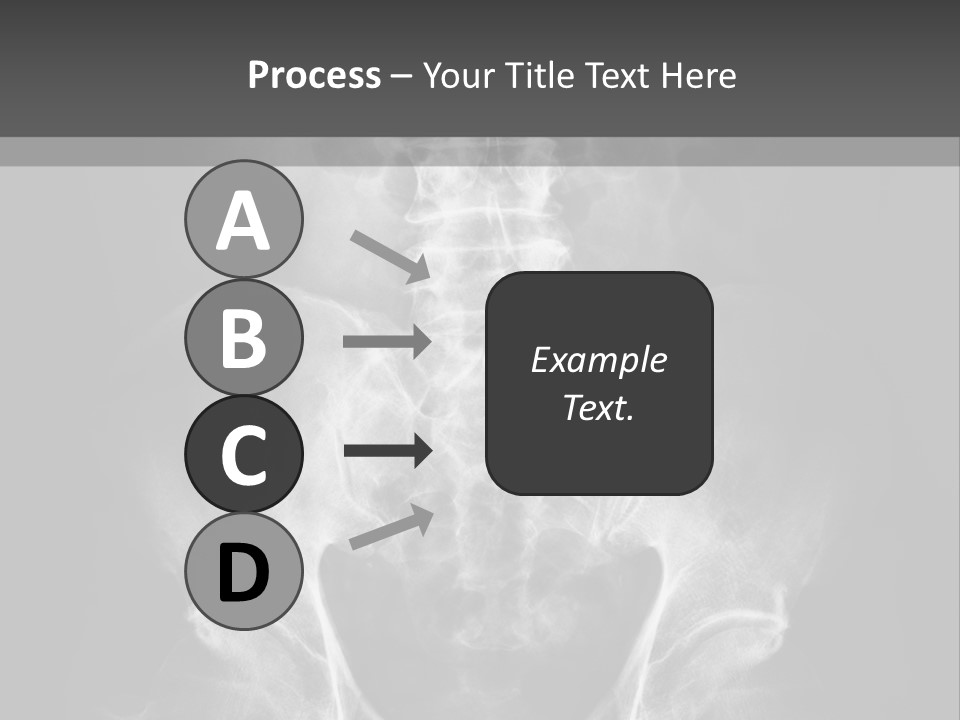 A X - Ray Image Of A Skeleton With The Words Name Of Presentation Company Name PowerPoint Template