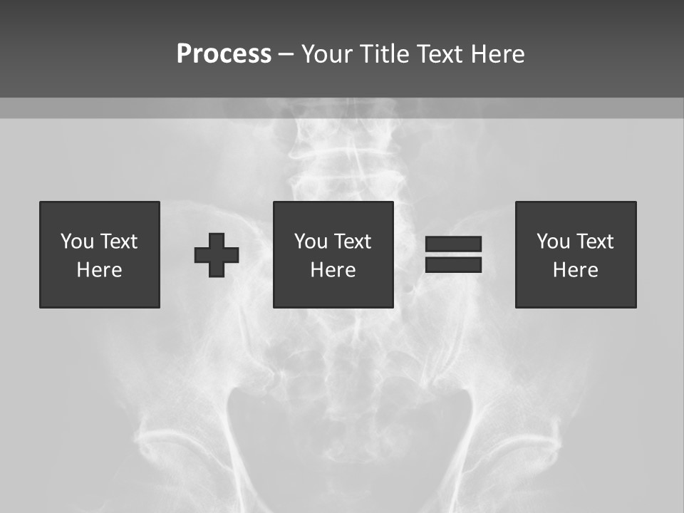 A X - Ray Image Of A Skeleton With The Words Name Of Presentation Company Name PowerPoint Template