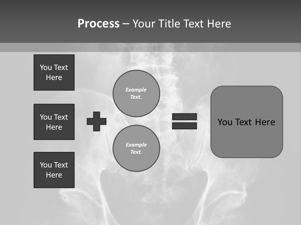 A X - Ray Image Of A Skeleton With The Words Name Of Presentation Company Name PowerPoint Template