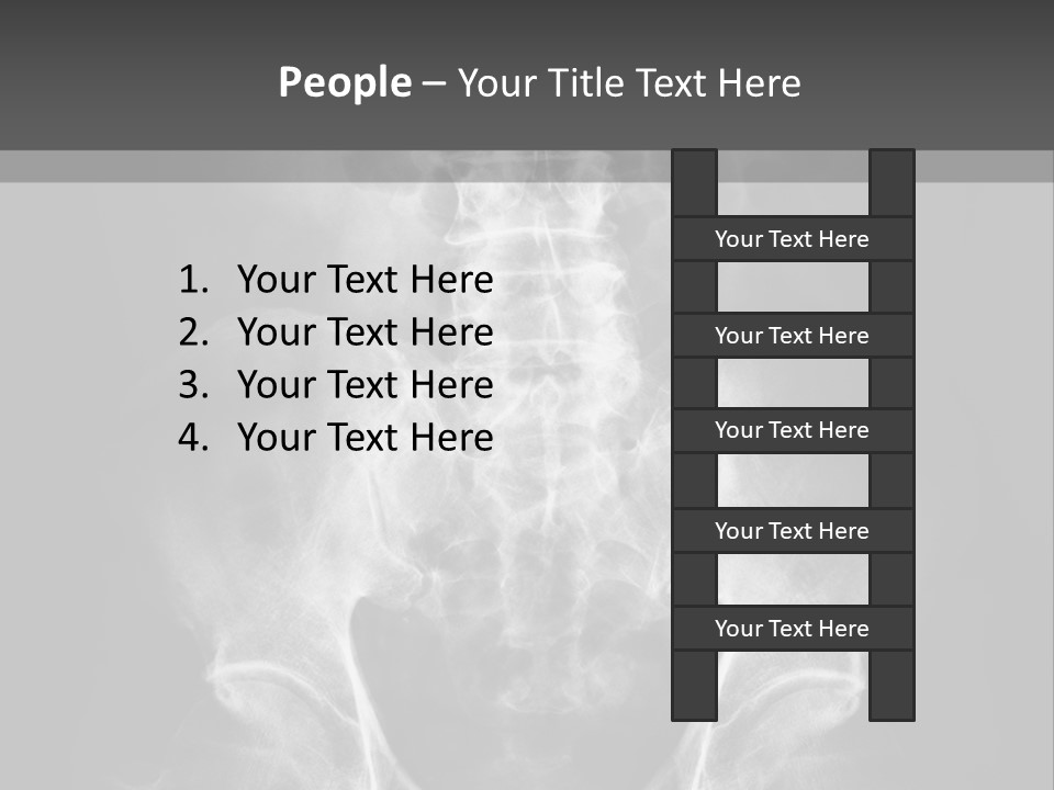 A X - Ray Image Of A Skeleton With The Words Name Of Presentation Company Name PowerPoint Template