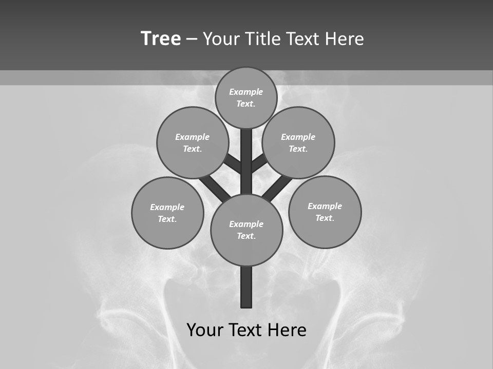 A X - Ray Image Of A Skeleton With The Words Name Of Presentation Company Name PowerPoint Template