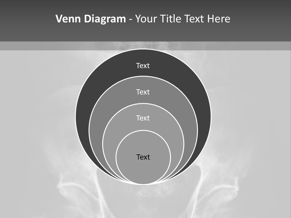 A X - Ray Image Of A Skeleton With The Words Name Of Presentation Company Name PowerPoint Template