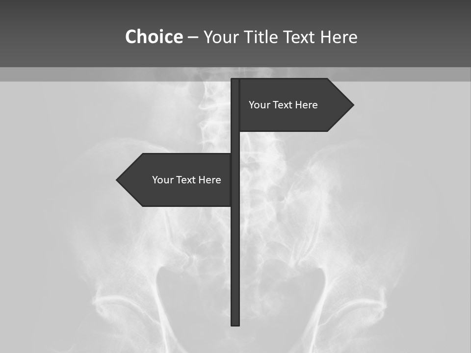 A X - Ray Image Of A Skeleton With The Words Name Of Presentation Company Name PowerPoint Template
