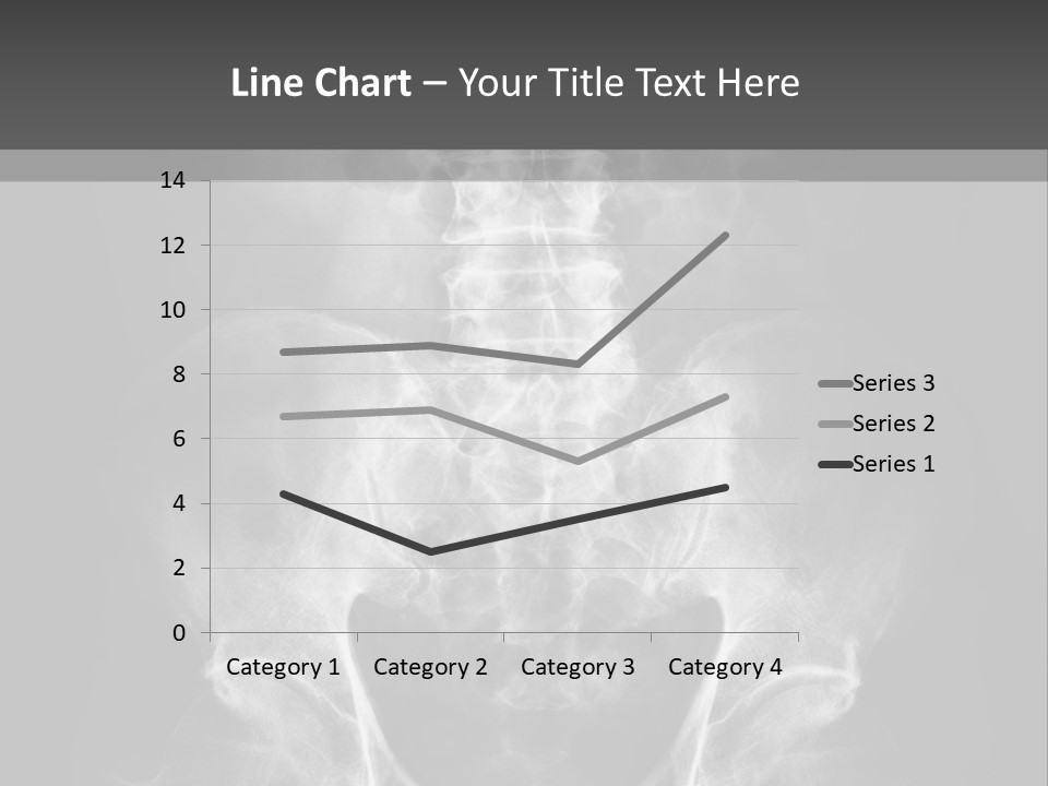 A X - Ray Image Of A Skeleton With The Words Name Of Presentation Company Name PowerPoint Template