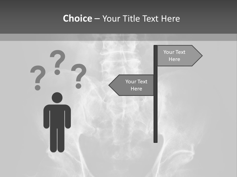 A X - Ray Image Of A Skeleton With The Words Name Of Presentation Company Name PowerPoint Template