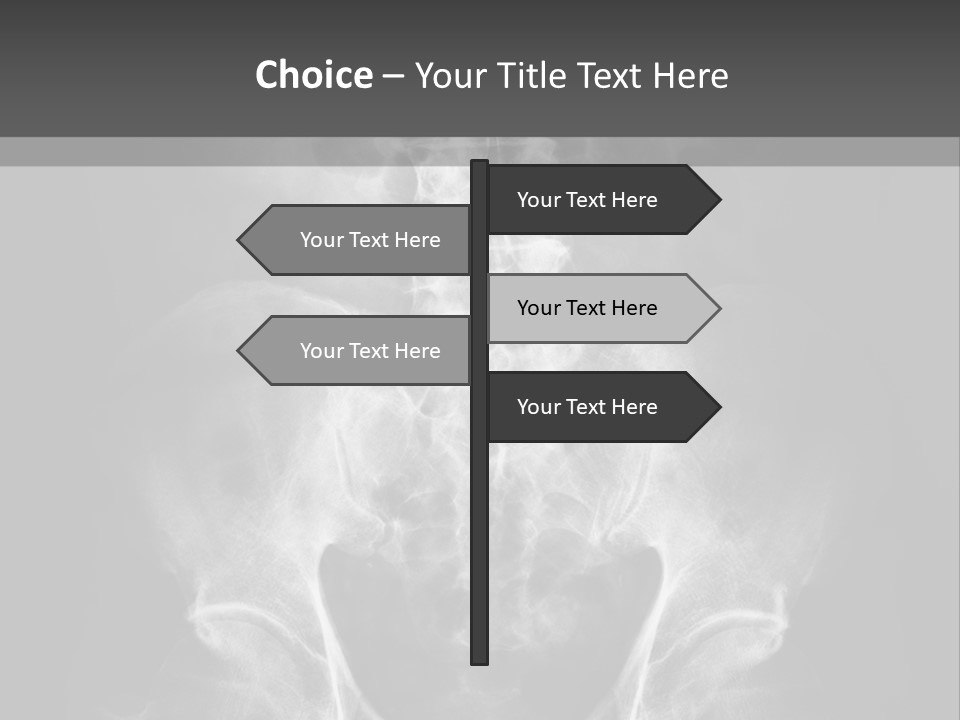 A X - Ray Image Of A Skeleton With The Words Name Of Presentation Company Name PowerPoint Template