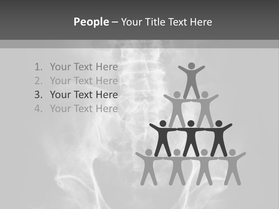 A X - Ray Image Of A Skeleton With The Words Name Of Presentation Company Name PowerPoint Template