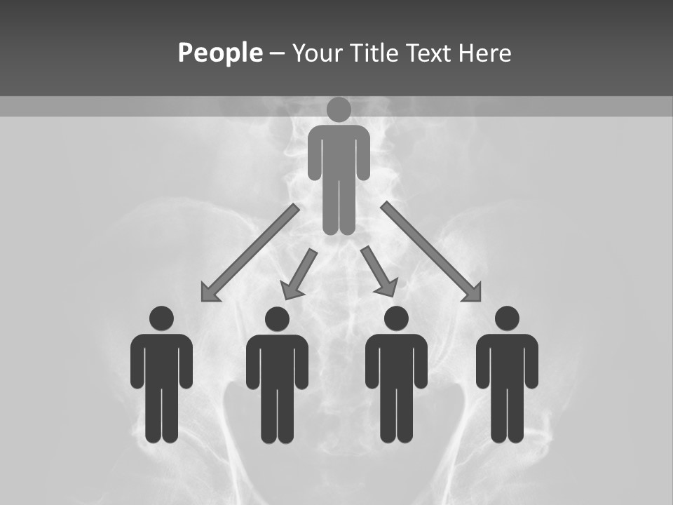 A X - Ray Image Of A Skeleton With The Words Name Of Presentation Company Name PowerPoint Template