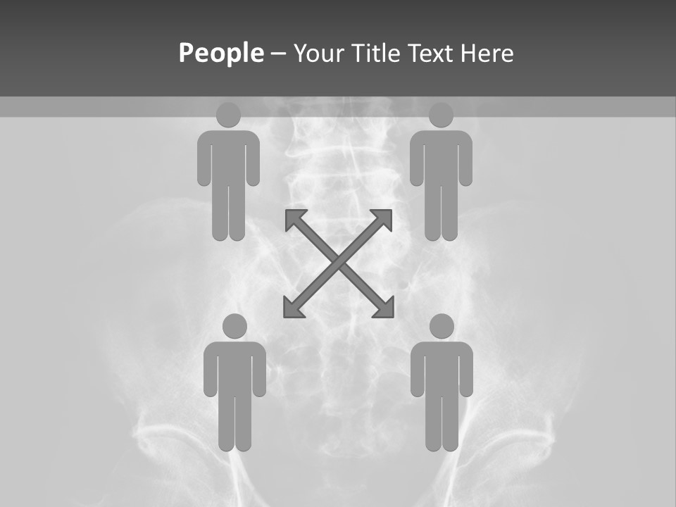 A X - Ray Image Of A Skeleton With The Words Name Of Presentation Company Name PowerPoint Template