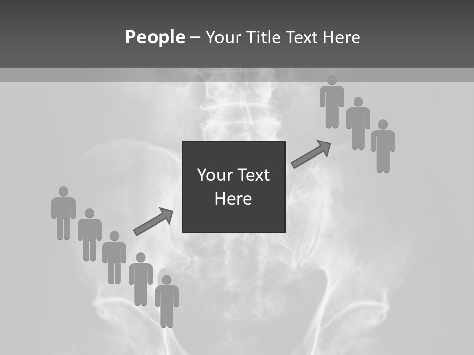 A X - Ray Image Of A Skeleton With The Words Name Of Presentation Company Name PowerPoint Template
