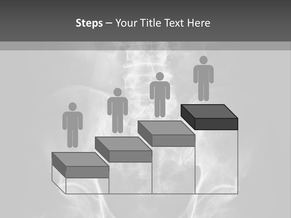 A X - Ray Image Of A Skeleton With The Words Name Of Presentation Company Name PowerPoint Template