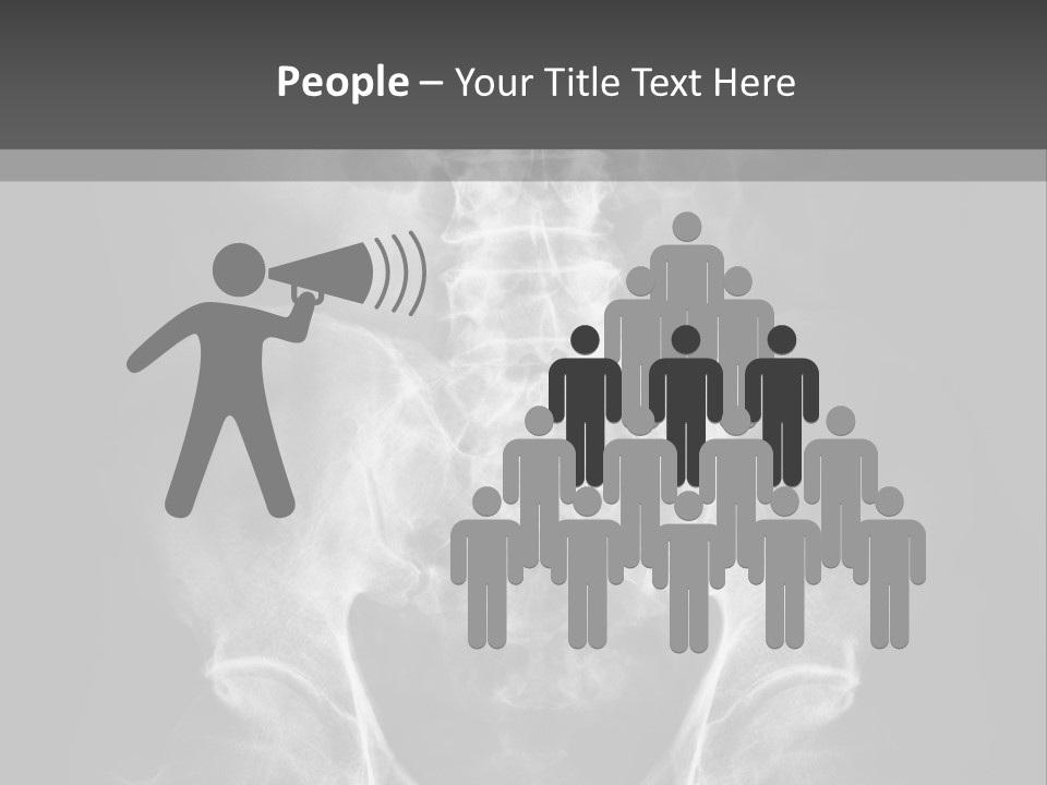 A X - Ray Image Of A Skeleton With The Words Name Of Presentation Company Name PowerPoint Template