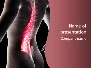 Chiropractor Hurt Head PowerPoint Template