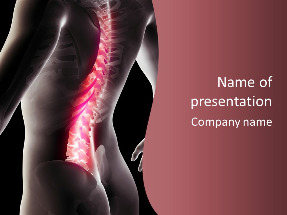 Chiropractor Hurt Head PowerPoint Template