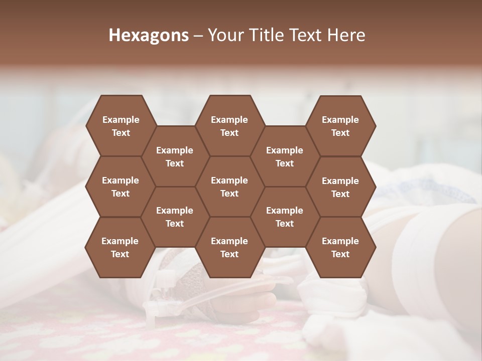 Intubation Pediatric Ill PowerPoint Template