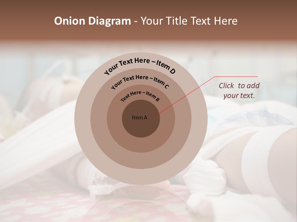 Intubation Pediatric Ill PowerPoint Template