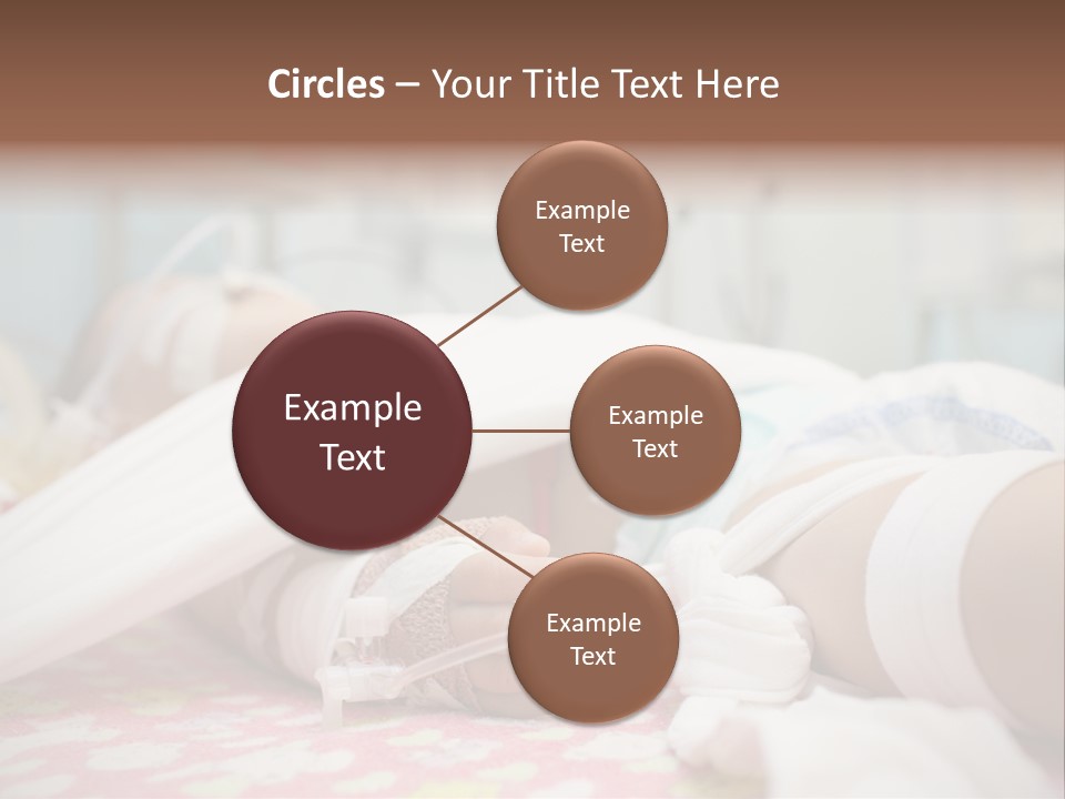 Intubation Pediatric Ill PowerPoint Template