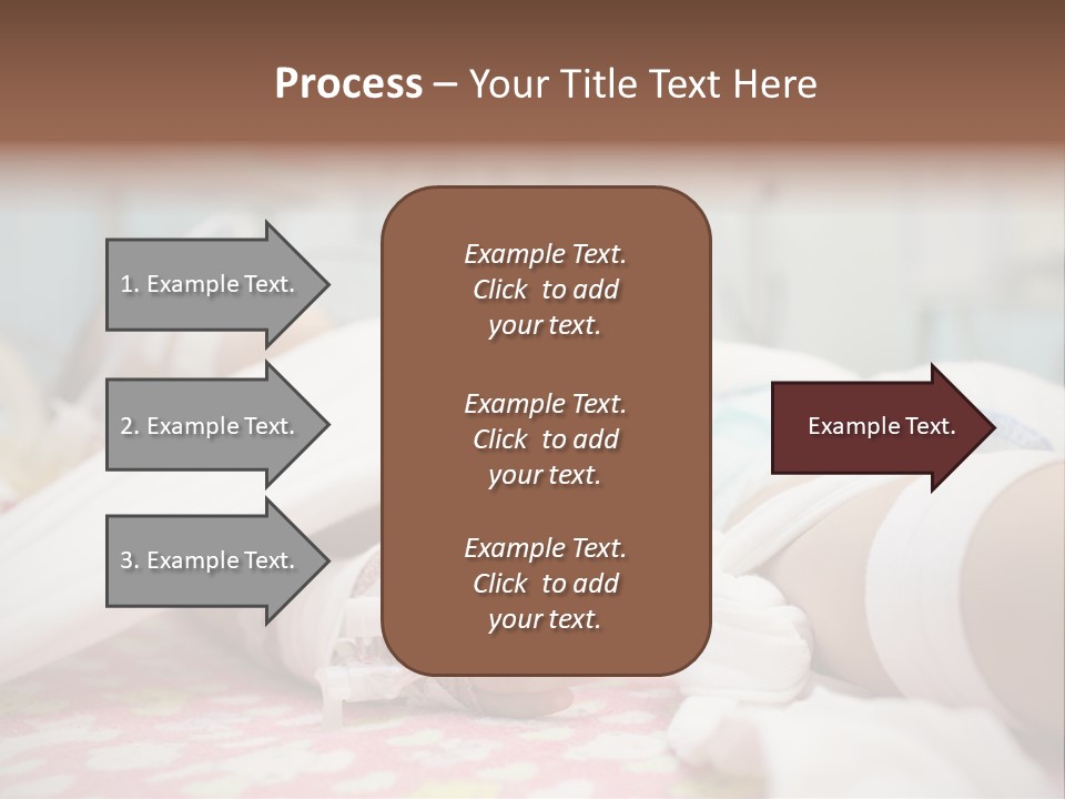 Intubation Pediatric Ill PowerPoint Template