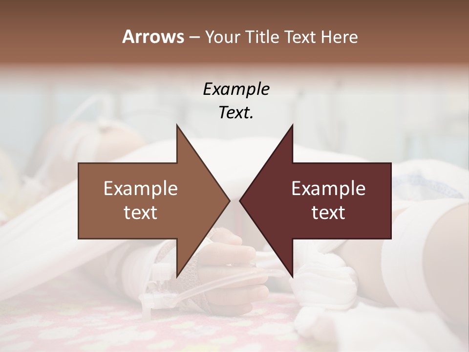 Intubation Pediatric Ill PowerPoint Template