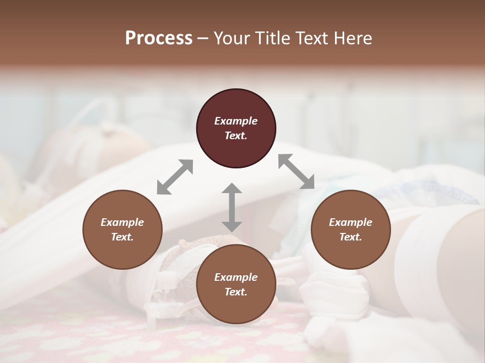 Intubation Pediatric Ill PowerPoint Template