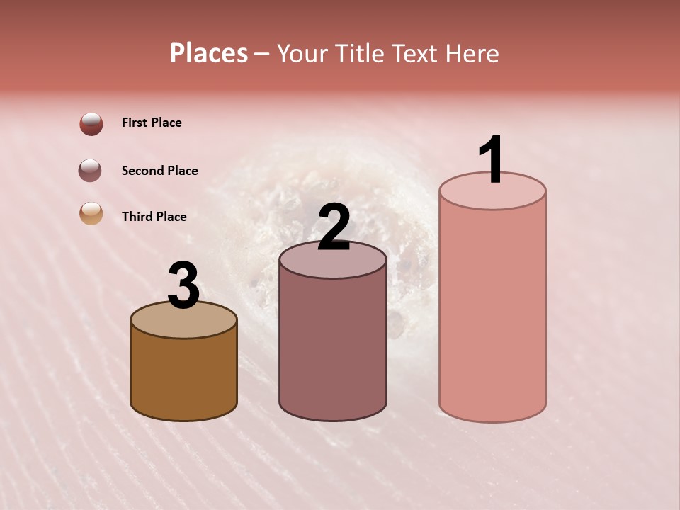 Macro Close Up Papillomavirus PowerPoint Template