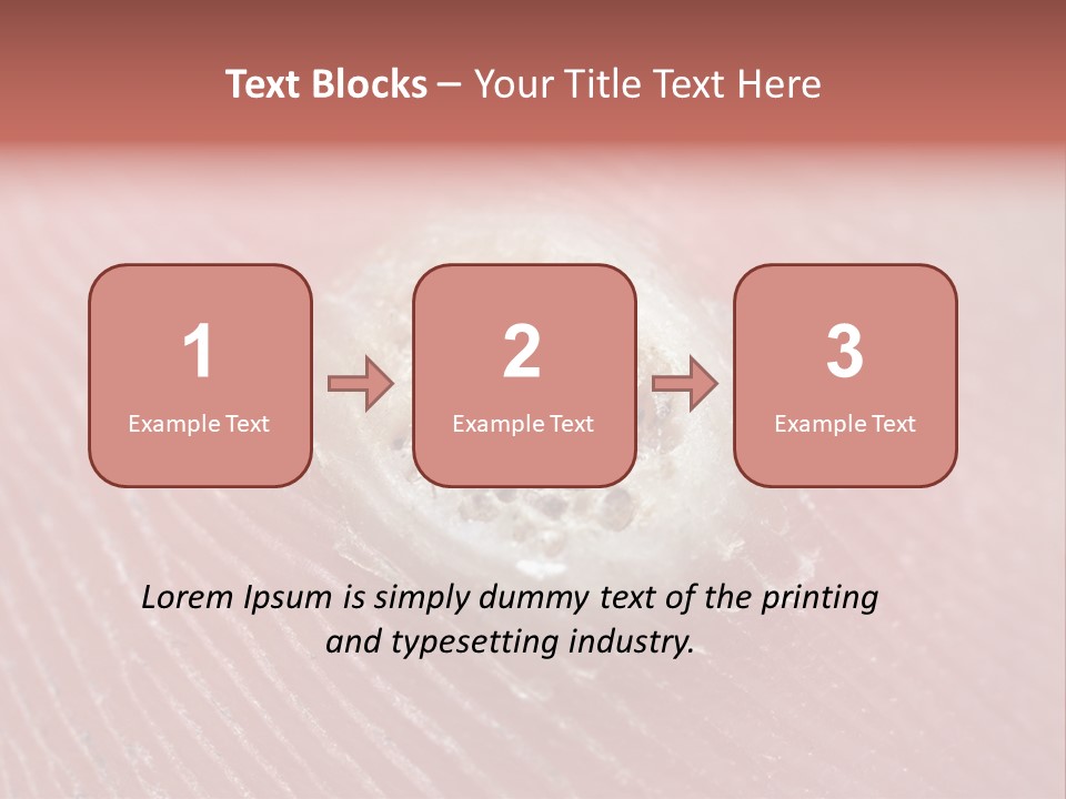Macro Close Up Papillomavirus PowerPoint Template
