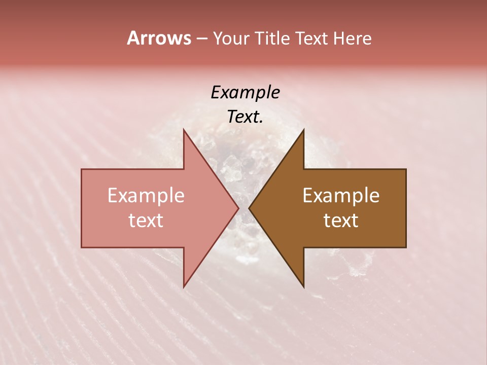 Macro Close Up Papillomavirus PowerPoint Template