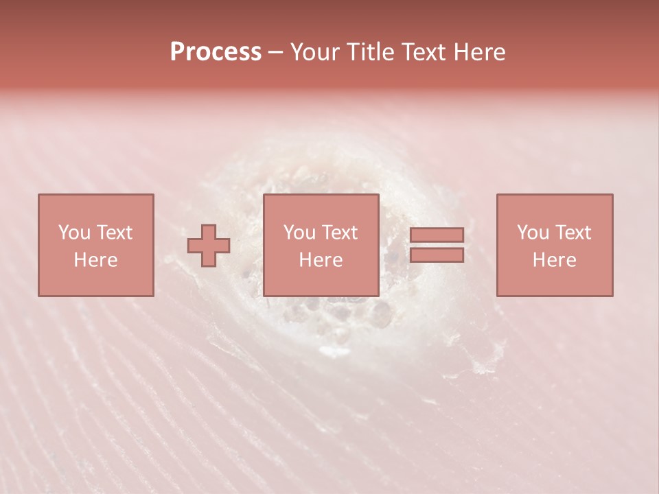 Macro Close Up Papillomavirus PowerPoint Template