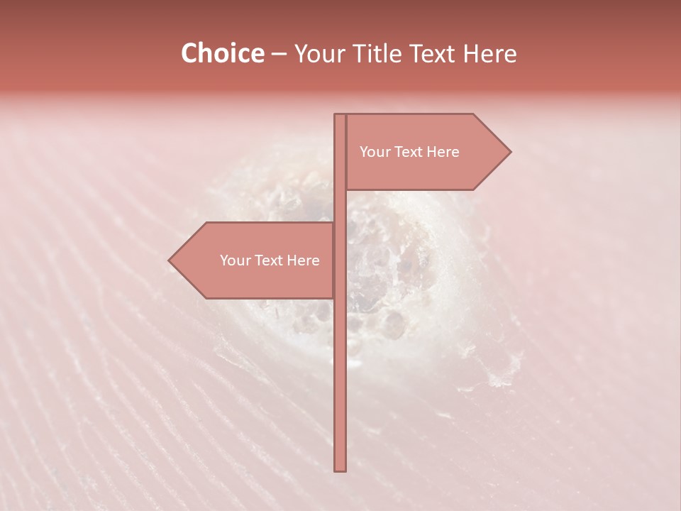 Macro Close Up Papillomavirus PowerPoint Template